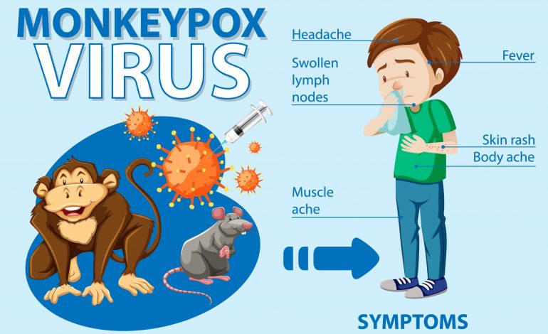  6 Things You Need To Know About Monkeypox